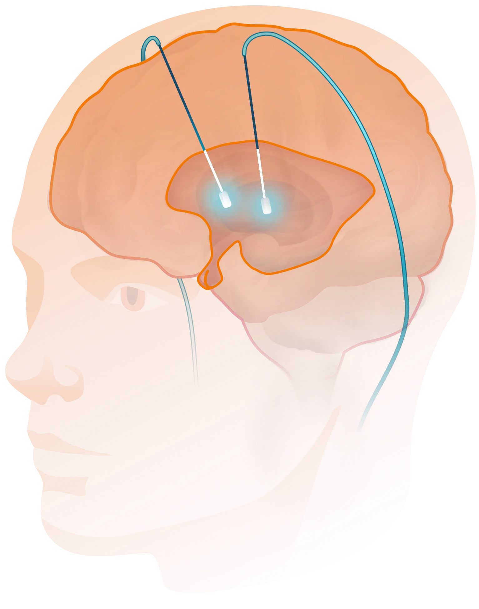 3.OBJECTIVE_Functional_Neural_Interfacing